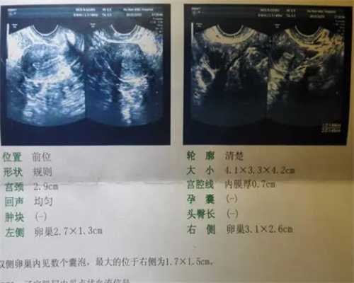 上海辅助代怀网,，做父母上海三代试管婴儿能选择性别吗